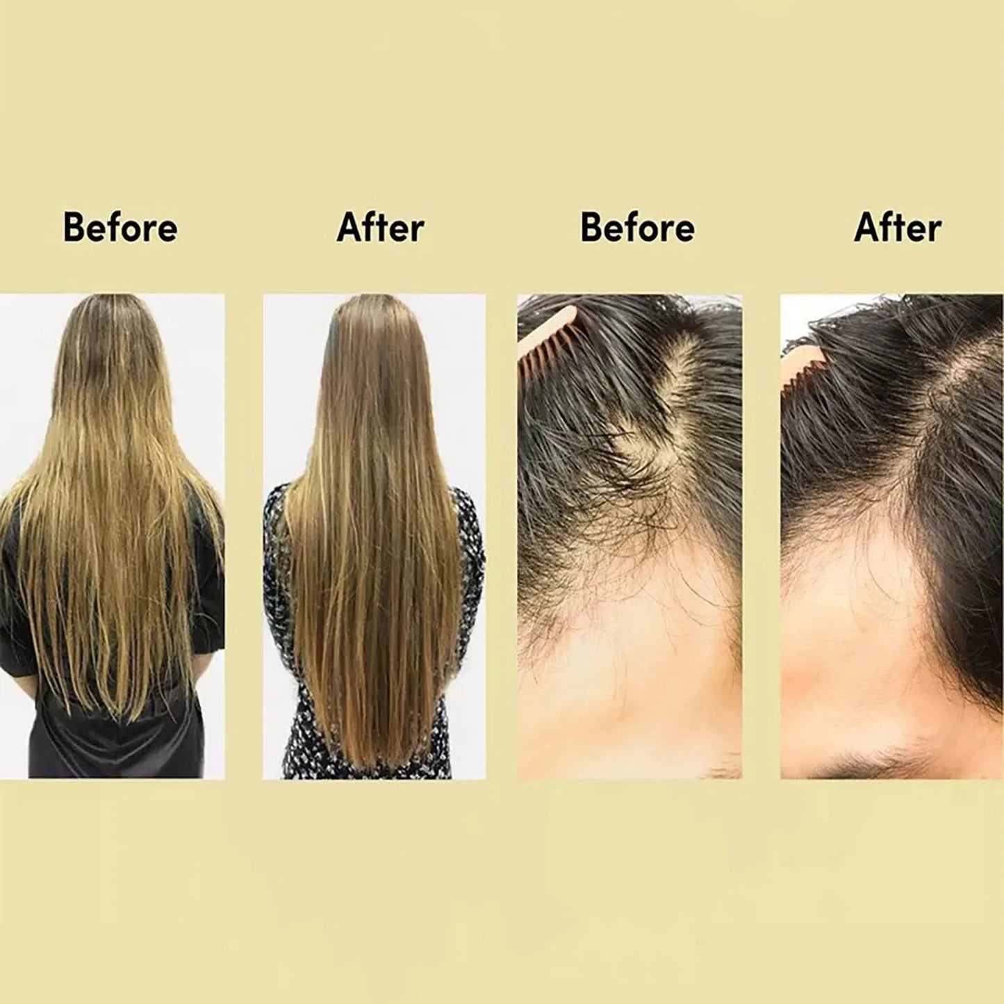 Roze Hair Growth Oil